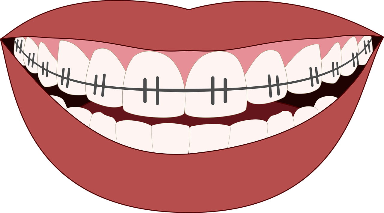 We offer orthodontic treatments at our clinic
